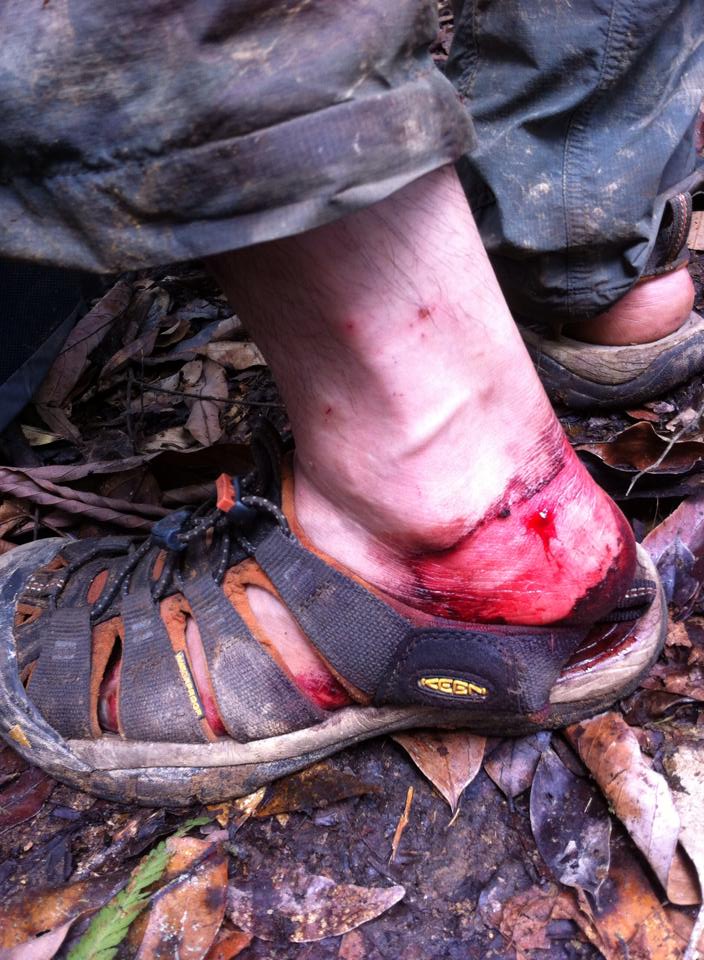 Podcast Stupid Tourist EP : (12/100) ว่าด้วยเรื่องของทาก (land leech)